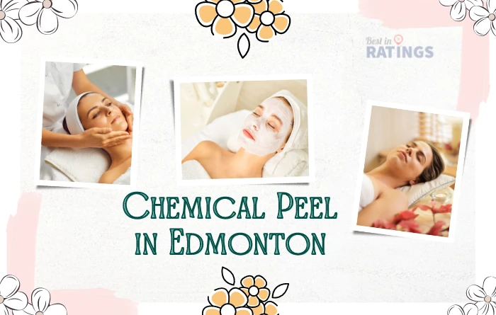 7 Top Places for Best Chemical Peel Treatment in Edmonton, AB