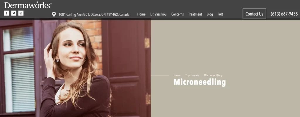 Screenshot of Microneedling section of Dermaworks website