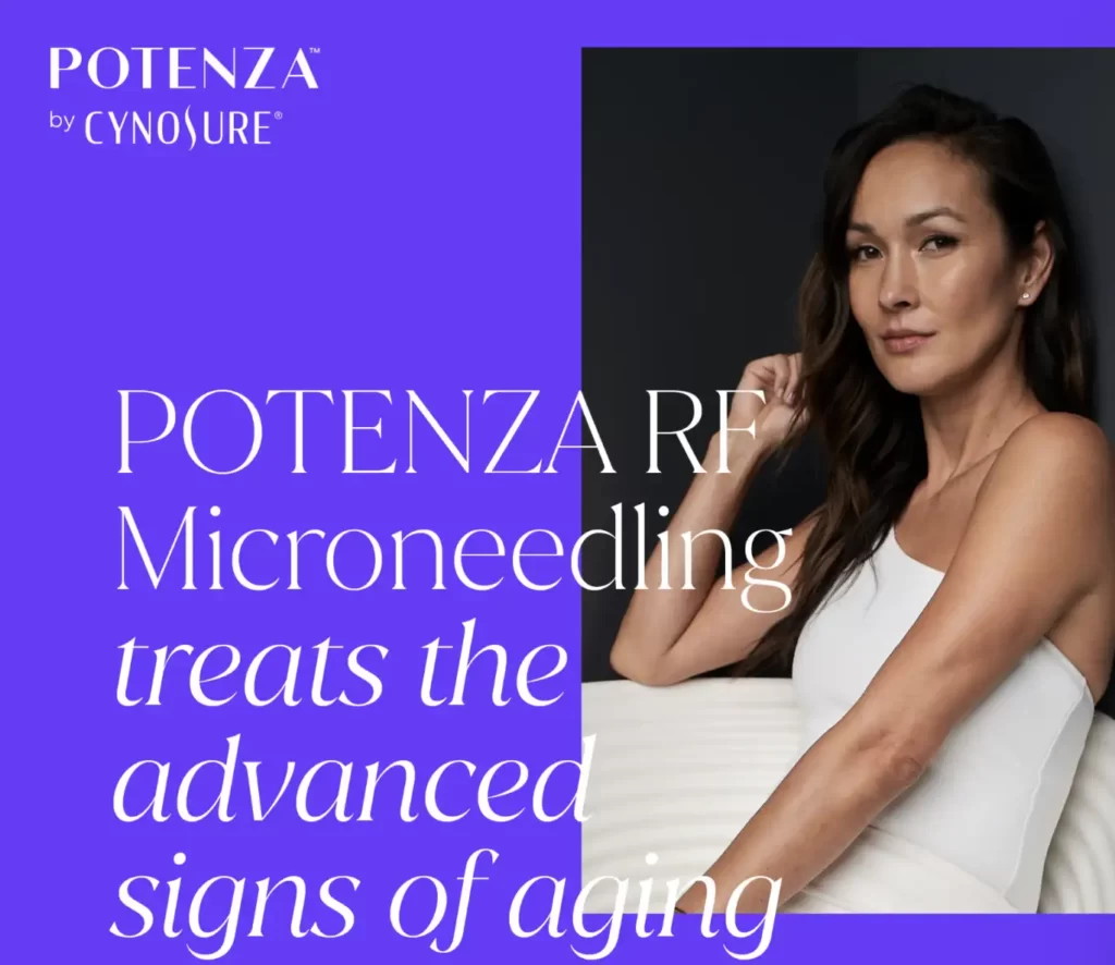 Banner image of Potenza™ microneedling treatment in Vancouver
