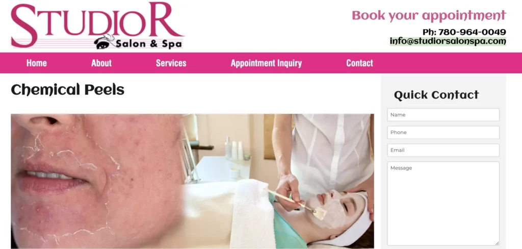 Website overview of chemical peel at Studio R Salon & Spa in Edmonton