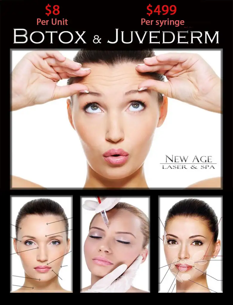 Cost of Botox injections at New Age Laser, Kitchener, Ontario
